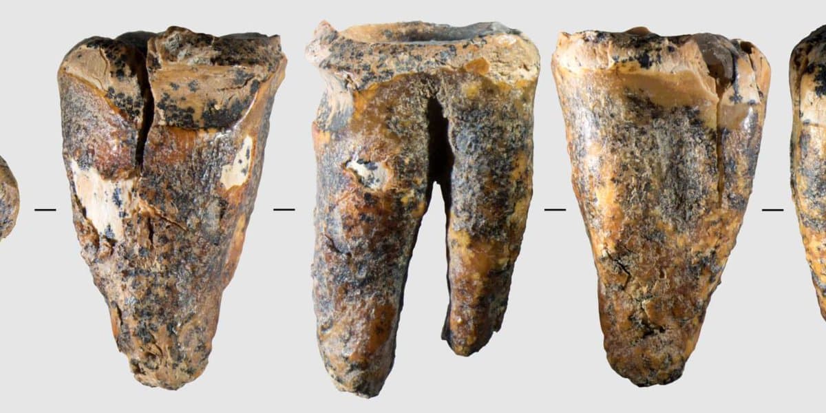 Via X This image, first published by the scientific journal PLOS One, shows multiple views of a 59,000-year-old Neanderthal molar bearing evidence of dentistry work.